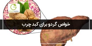 آیا خواص گردو برای کبد چرب مناسب است؟(برسی کامل)